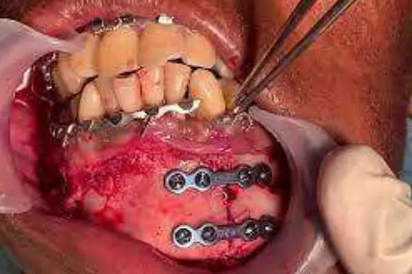 Punnagaiy Dental Clinic