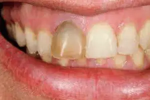 Punnagaiy Dental Clinic
