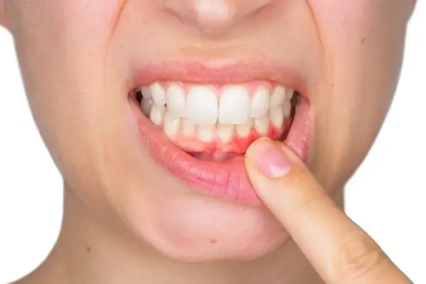 periodontics4