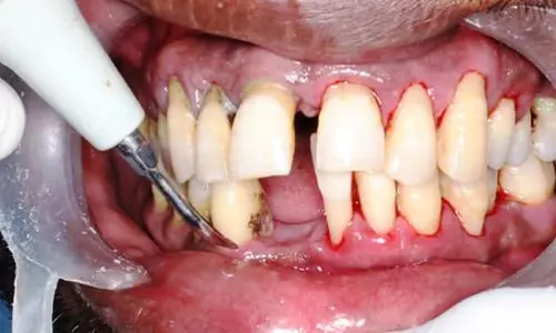 periodontics6