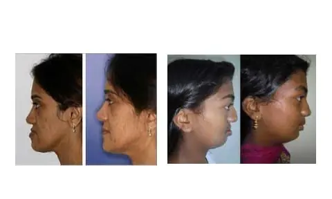 surgical3