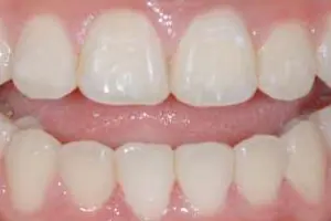 Untitled-2
