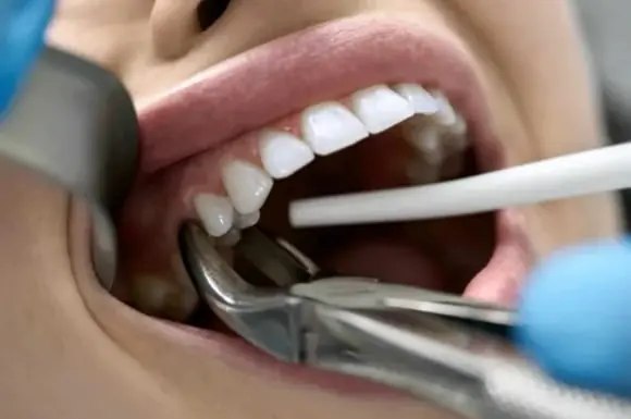 surgical