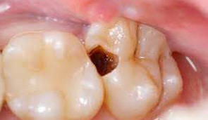 restorative4