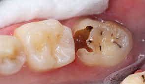 restorative5