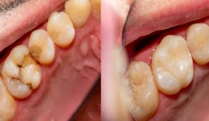 restorative8jpg.