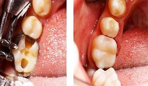 restorative9